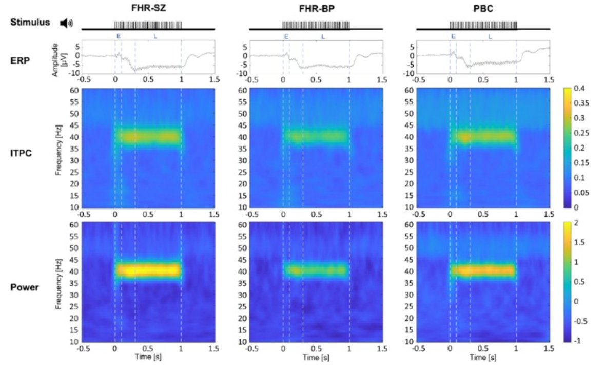 eic_nic's tweet image. JUST OUT:
Comparable 40 Hz auditory steady-state responses in children at familial high risk for schizophrenia or bipolar disorder and population-based controls
New work from Larsen et al
sciencedirect.com/science/articl…