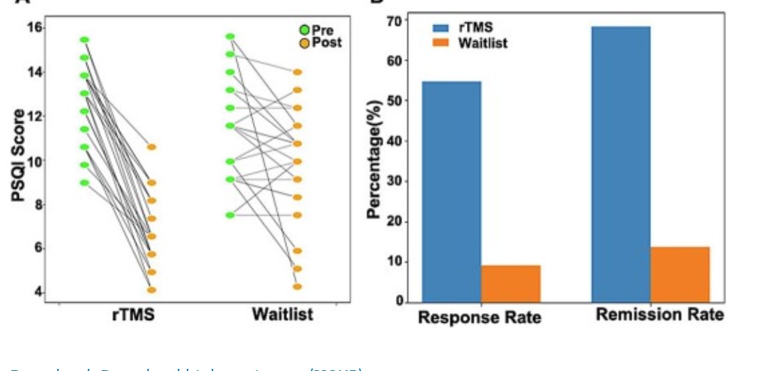 eic_nic's tweet image. NEW WORK: Precision targeting of right dorsolateral prefrontal cortex with neuronavigated rTMS alleviates chronic insomnia via functional connectivity reorganization: a randomized neuroimaging trial
From Liang Gong et al:
sciencedirect.com/science/articl…
