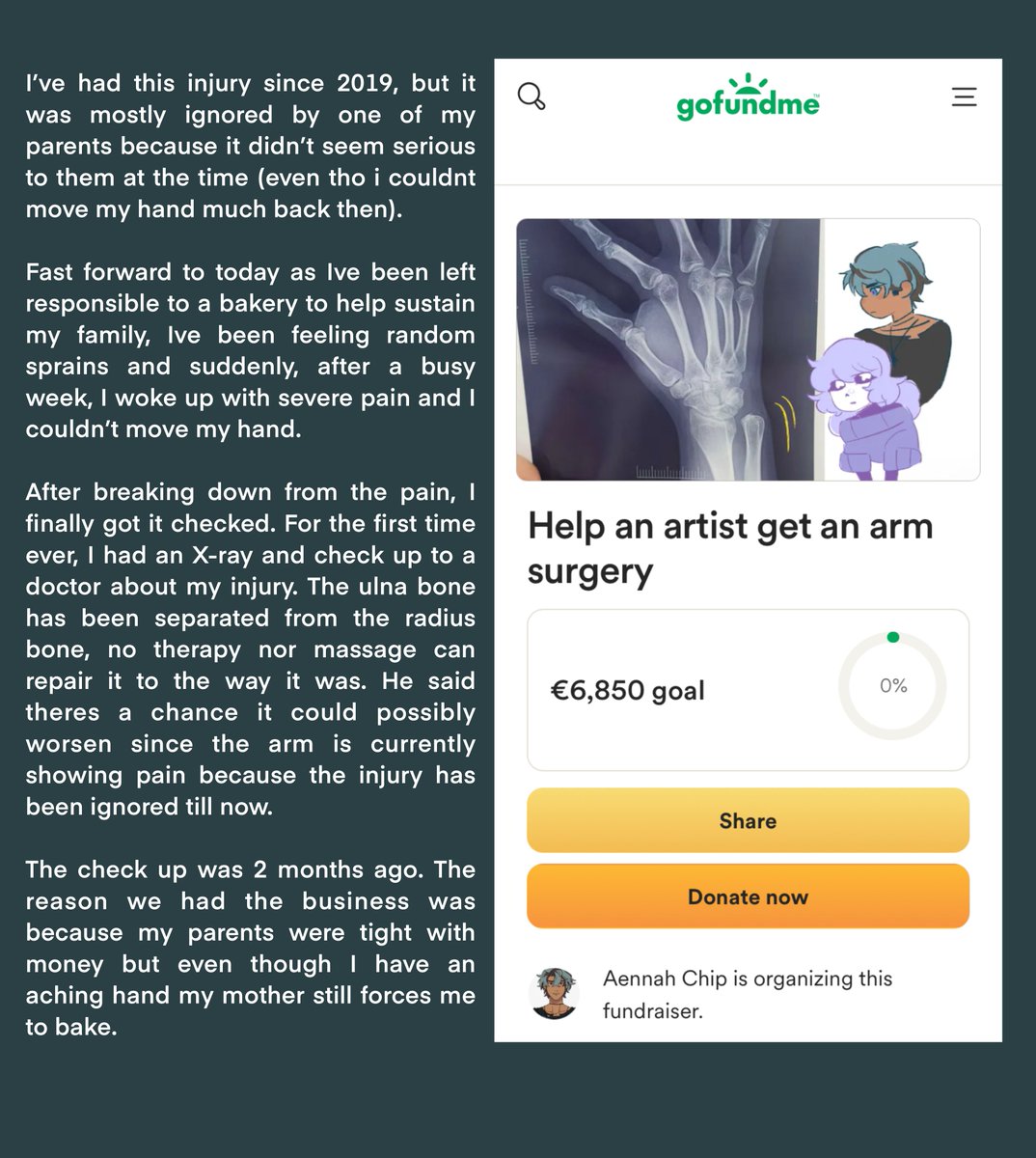 Help an artist get arm surgery (1/?)
🧵
#gofundme