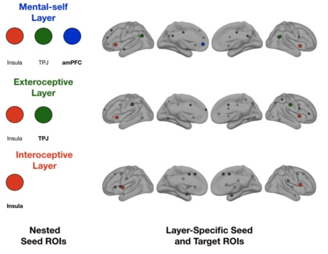 eic_nic's tweet image. A new contribution to our Special Issue on FND:
Altered self-processing brain networks in paediatric functional neurological disorder
From Ishan Walpola, Kasia Kozlowska and team:
sciencedirect.com/science/articl…