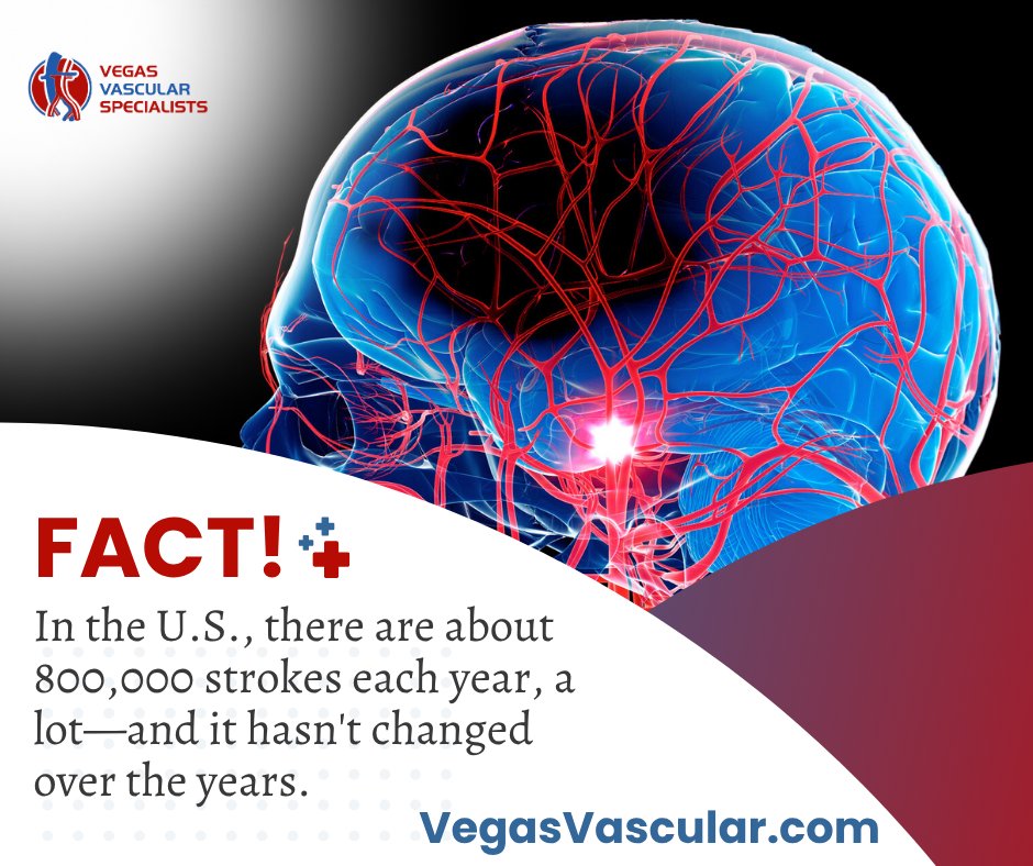 Carotid artery disease, a condition that narrows the arteries supplying blood to the brain, is a significant risk factor for stroke.

Visit VegasVascular.com. Click the Request an Appointment button or call (702) 565-8346 to get started today.

#VegasVascularSpecialists