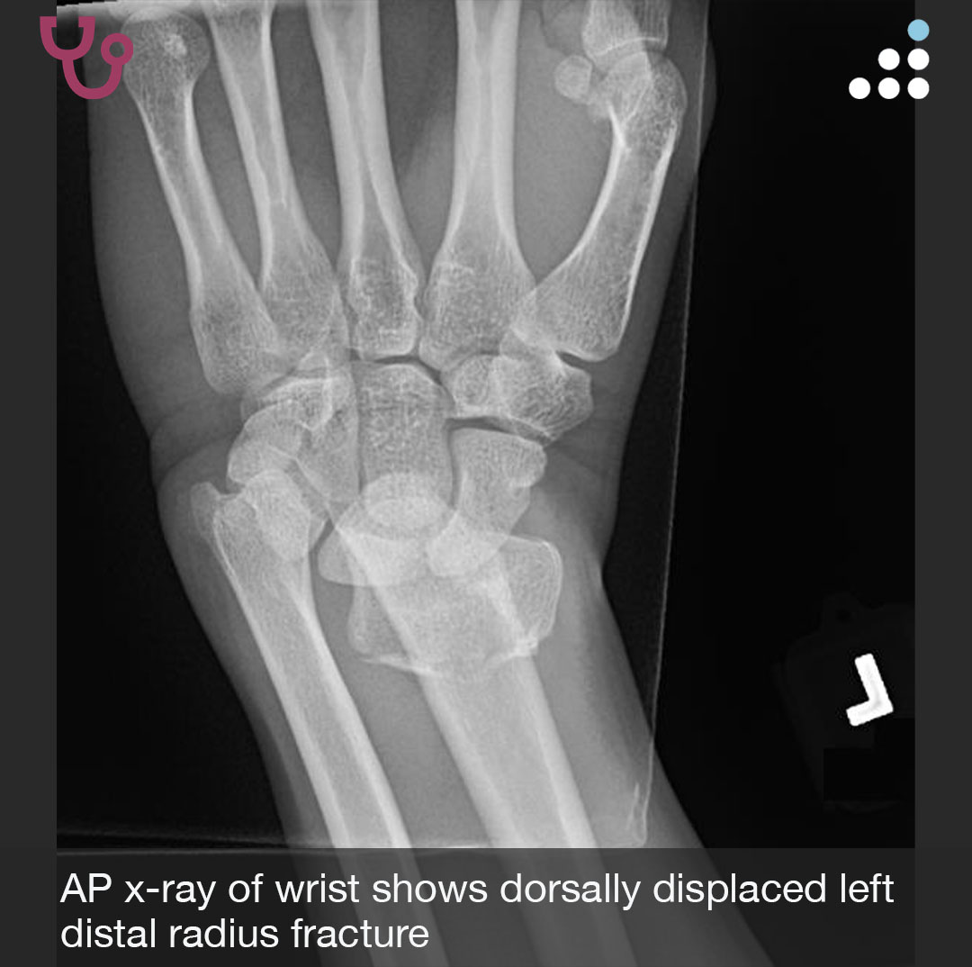 Orthobullets tweet media