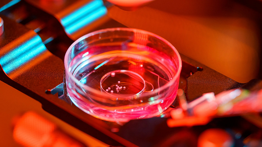 KnowledgeZoneIn's tweet photo. #ITByte: Researchers have proposed using artificial #Brain  #Organoids to create next-generation #Biocomputers, which could theoretically outperform silicon-based computers.

It promises unprecedented advances in computing speed, and storage capabilities.

https://t.co/GFjy0PdbWm https://t.co/pIUAoHRNi9