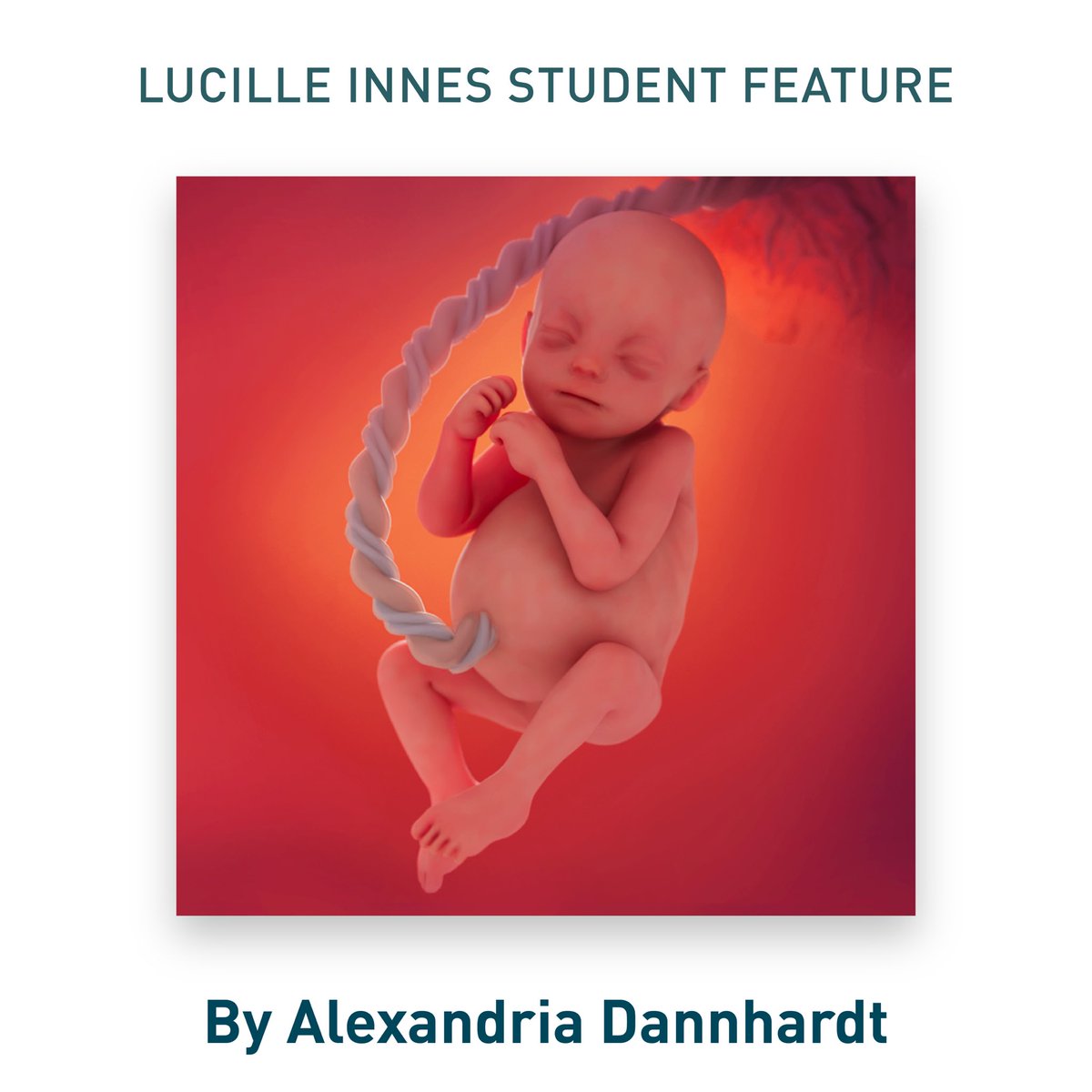 Introducing Alexandria Dannhardt, featured student presenter, at the #VesaliusTrust Lucille Innes Student Showcase on Fri, July 18, 2025 (3:00–4:30 pm) at the <a href="/AMIdotorg/">AMI</a> annual mtg in Grand Rapids, MI. Stop by, meet the recent grads &amp; see what they have been working on. #medart