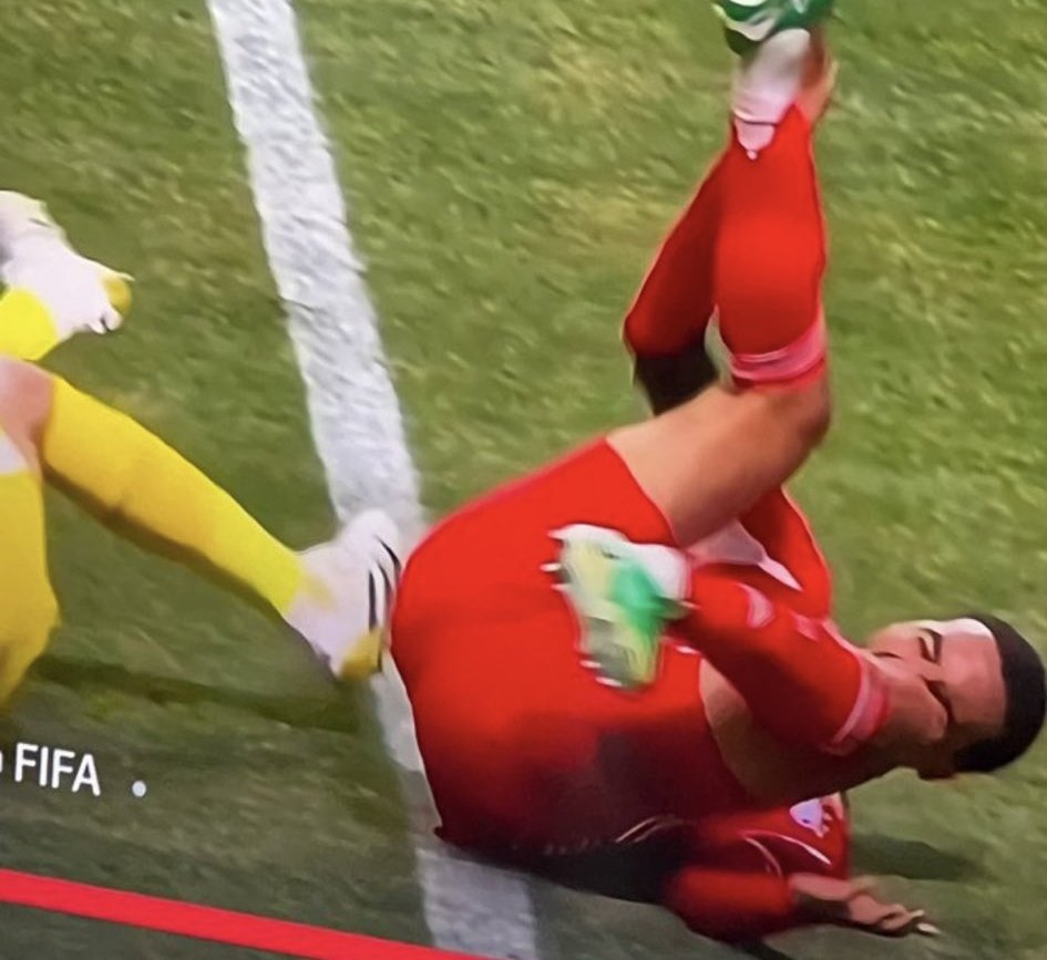 La cheville de Jamal #Musiala. 😬😔

#FCBayern ||  #FIFACWC || #TakeItToTheWorld || #FIFAClubWorldCup 🏆🇺🇸 || #Transferts || #Mercato || #Bundesliga || #MiaSanMia 🔴⚪️