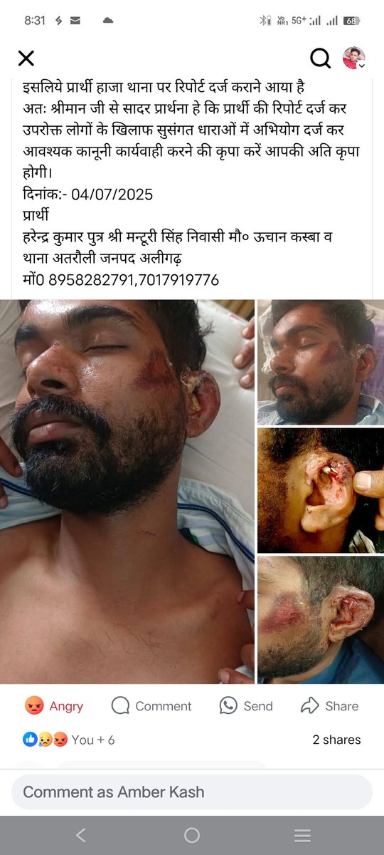 gagankumar93's tweet photo. #CMYogiAdityanath #PMModi #plz #aligarhsupport #aligarhpolice #atraulipolice Uttar Pradesh government. https://t.co/isxFpq7xHk