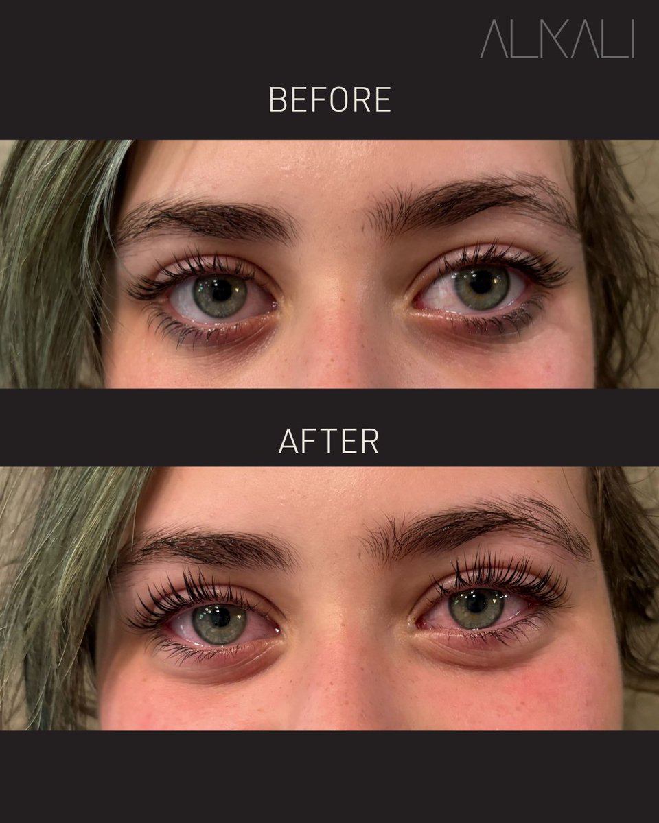 AlkaliHair's tweet image. Check out this #lashlift Jes Harding gave her client Opal. The results are stunning! 😍

Want #lashes dreams are made of? Book with Jes online or call 336-724-1453.  bit.ly/4mVBPlc

#winstonsalemesthetician #lashesonlashes #alkaliwsnc