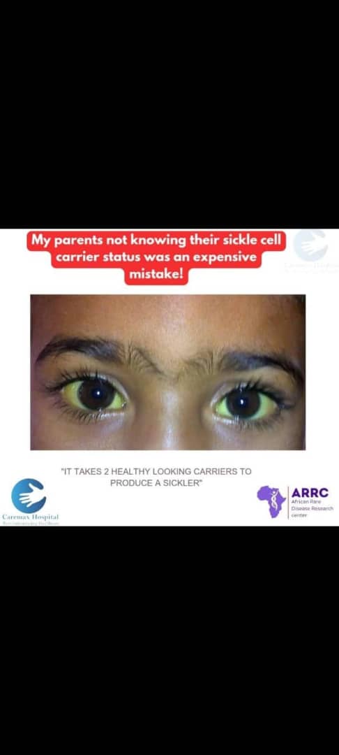 Radio talk show on sickle cell disease