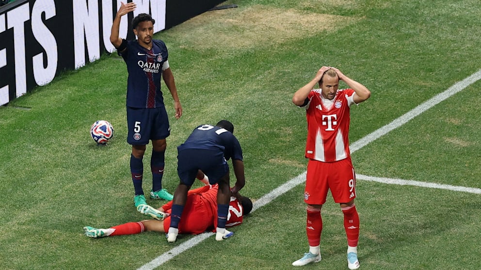 Jamal Musiala has broken his left fibula and damaged several ligaments. He will likely be out for 4-5 months [<a href="/BILD/">BILD</a>]