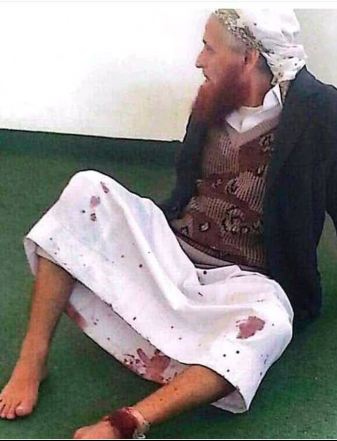 الى اهل ذمار خاصة وإلى أهل اليمن عامة ورد في الحديث أن الله ليستحيي من ذو شيبة والحوثي يصيب ويقتل شيباننا من العلماء والدعاة بدون حياء انتصروا للشيخ المسن علي حفظ الله الاهنومي