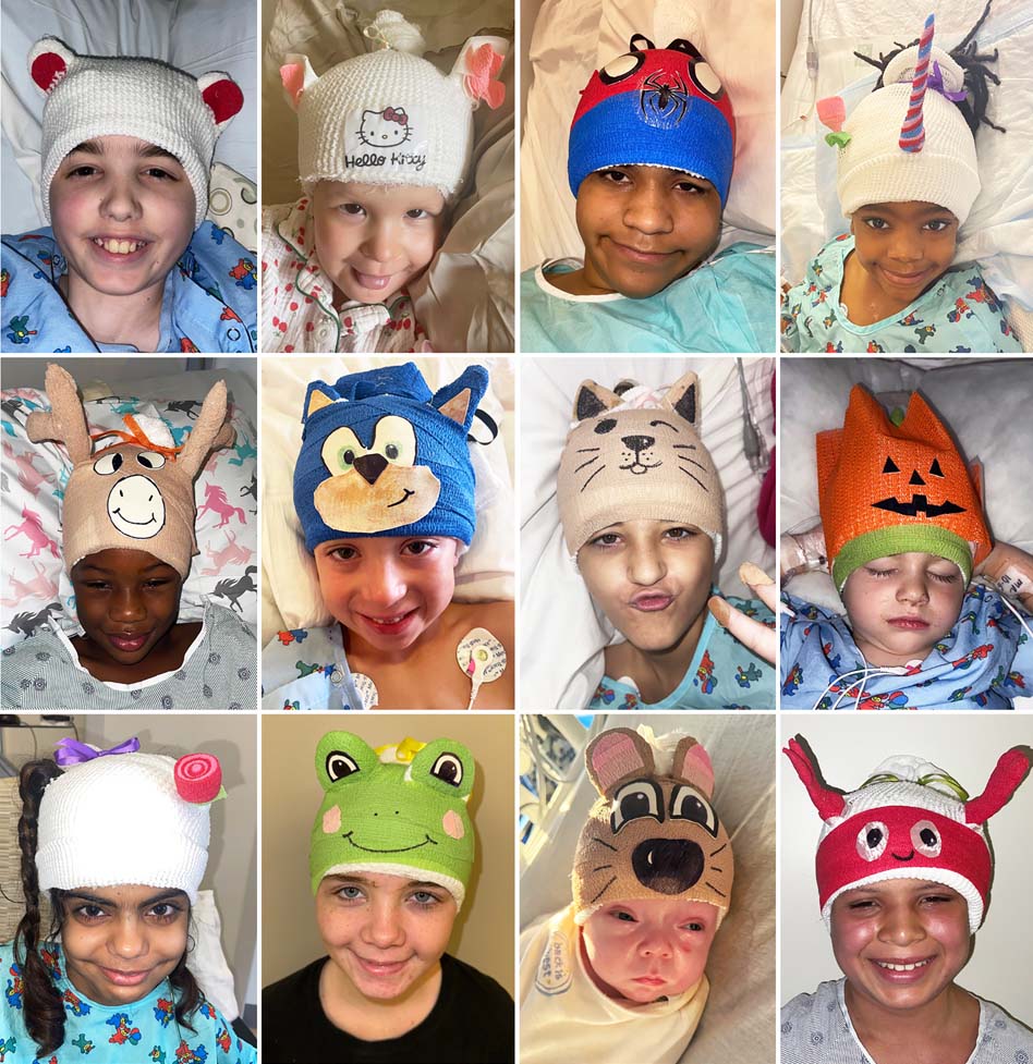 The Art of the (W)rap
Journal of Neurosurgery: Pediatrics, July 2025
FIG. 2. Examples of the unique head bandages
© Alan R. Cohen, published with permission
Johns Hopkins University School of Medicine