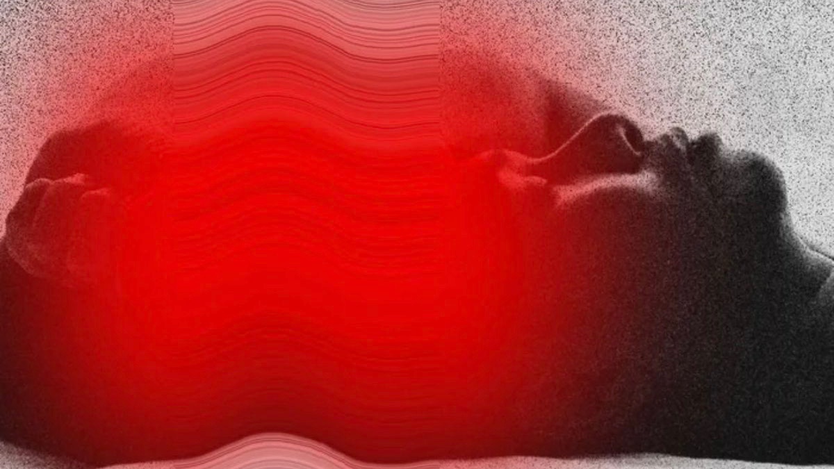 DrScomaME_CFS's tweet image. Post-exertional malaise (PEM) is the central physiologic barrier in ME/CFS and ~50% of Long COVID. While difficult to substantially modify, I have observed durable and reproducible partial mitigation of crash intensity and duration with targeted pharmacologic support.