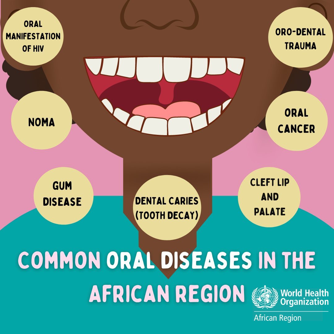 WHOAFRO's tweet photo. Oral diseases are alarmingly common in the African region, affecting nearly half of the population.

If left untreated, oral diseases can cause:

🔴 Pain
🔴 Discomfort
🔴 Disfigurement
🔴 and even death.

Be sure to take care of your oral health🦷. 
Let’s protect every smile. https://t.co/T17jpHtFyO