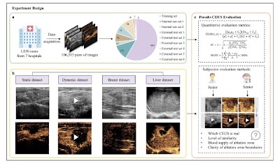 #GAN method generates pseudo-contrast enhanced ultrasound images to assess tumor response doi.org/10.1148/ryai.2… <a href="/CAS__Science/">Chinese Academy of Sciences</a> <a href="/Tongji_Uni/">Tongji University</a> #ultrasound #AI #ML