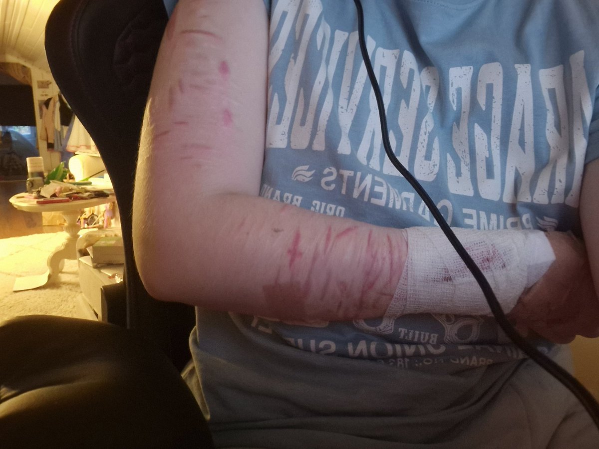 Where on my arm?:3