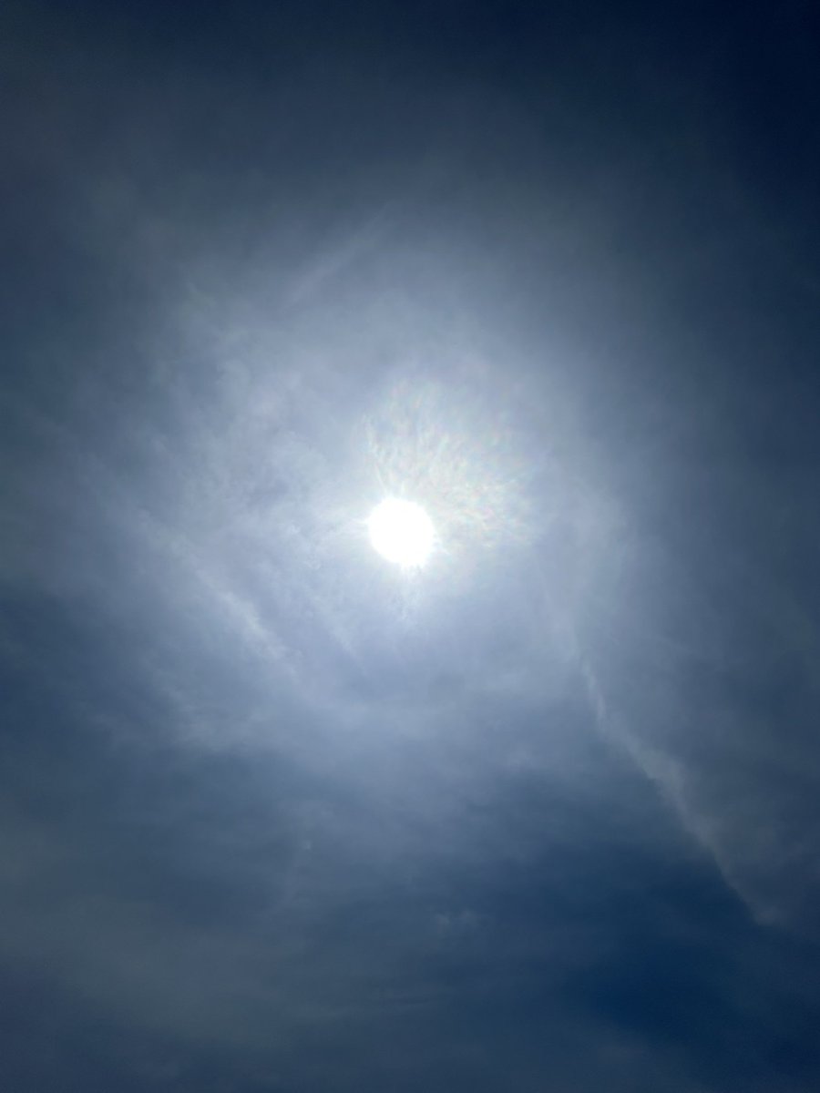 Sunburn? 

Idk her.

The tan just appears &amp; that’s it. No chemical filled shit going into my skin other than tallow &amp; ocean water.