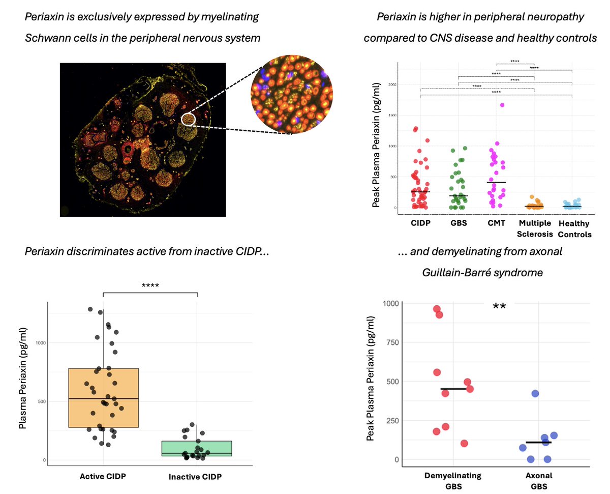 Bellanti et al. have developed an ultrasensitive assay for periaxin, a biomarker of peripheral nerve demyelination. When used alongside existing tests, the assay has the potential to improve the clinical management of peripheral neuropathy. tinyurl.com/4rbwjh67