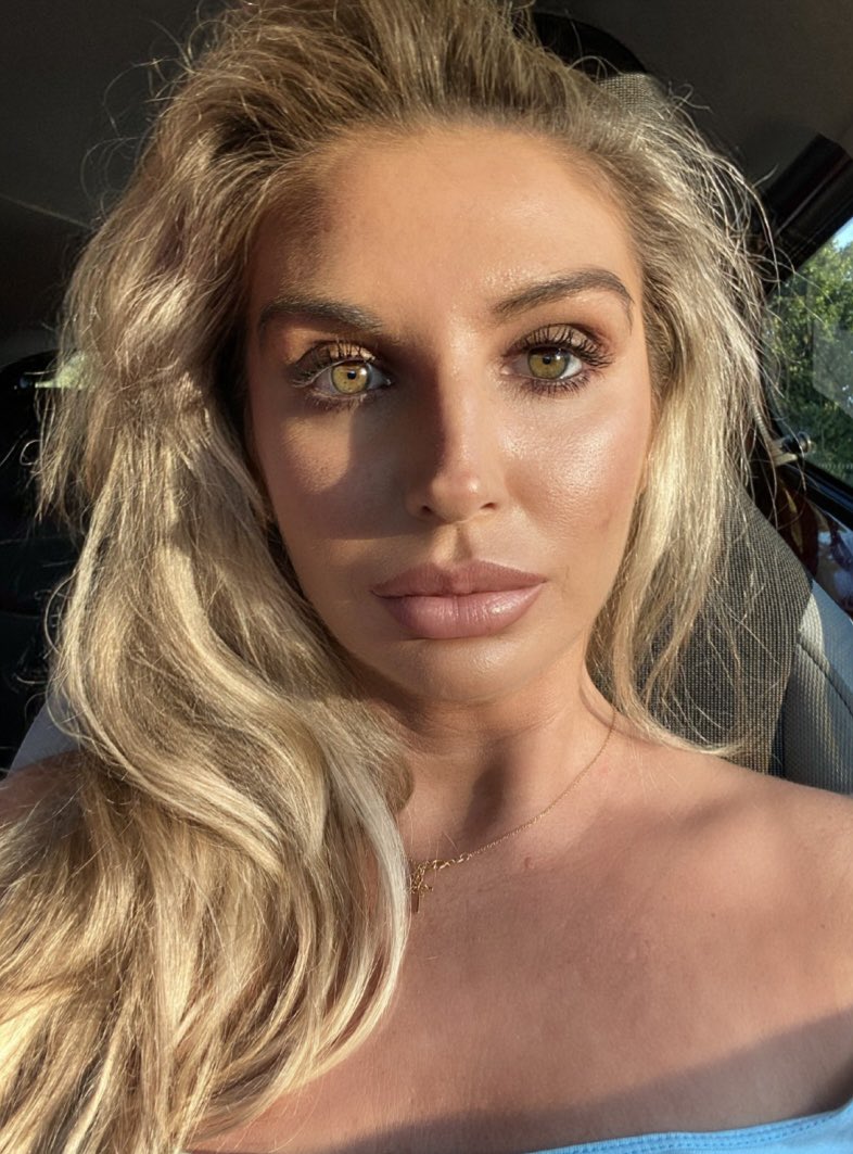 When the sunlight hits your eyes ☀️ (one eye is naturally darker than the other)