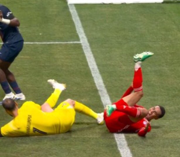 Tsportsanalysis's tweet image. 🚨 BREAKING: Bayern Munich's star midfielder Jamal Musiala faces a significant setback with a fractured left fibula and multiple ligament injuries according to BILD. 
The young talent is expected to be sidelined for 4-5 months. 🏥⚽ 

#getwellsoonmusiala #ClubWorldCup