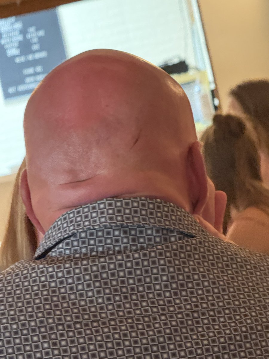 Kelly Garrett (@kellygarrett75) on Twitter photo This is <a href="/77mikewilliams/">Mike Williams</a> note the scratch. He just had his one year anniversary. When I asked what happened to his head all he will say is
Ceiling fan.
Draw your own conclusions This is <a href="/77mikewilliams/">Mike Williams</a> note the scratch. He just had his one year anniversary. When I asked what happened to his head all he will say is
Ceiling fan.
Draw your own conclusions