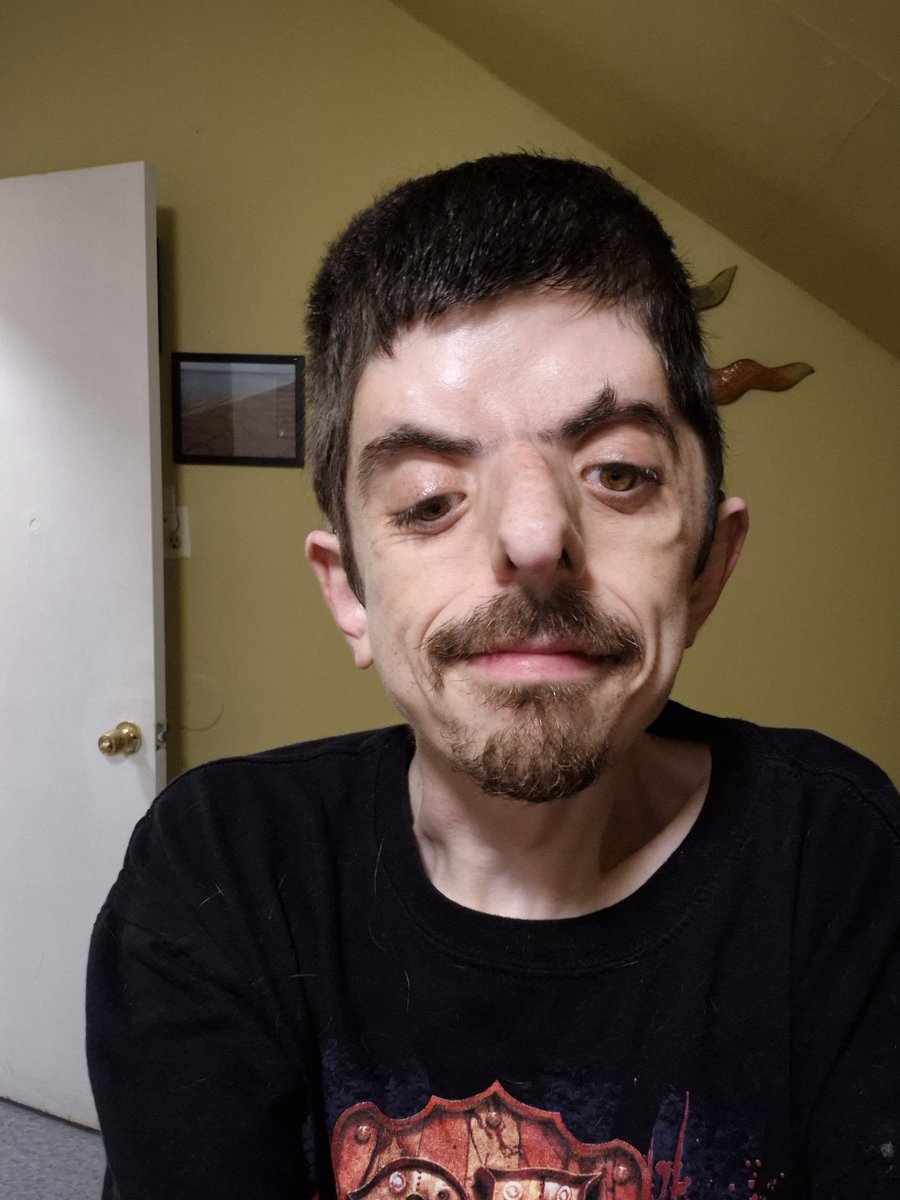 Ultimate_Tye's tweet image. My brother's girlfriend is trying to learn a new hobby (i think she's also considering cosmetology school, not positive anymore) and to work on my hair, shape it up. I said sure!
One buzzcut later 😂 thankfully, I wear my hair short most of the time anyway. So no harm, no foul.