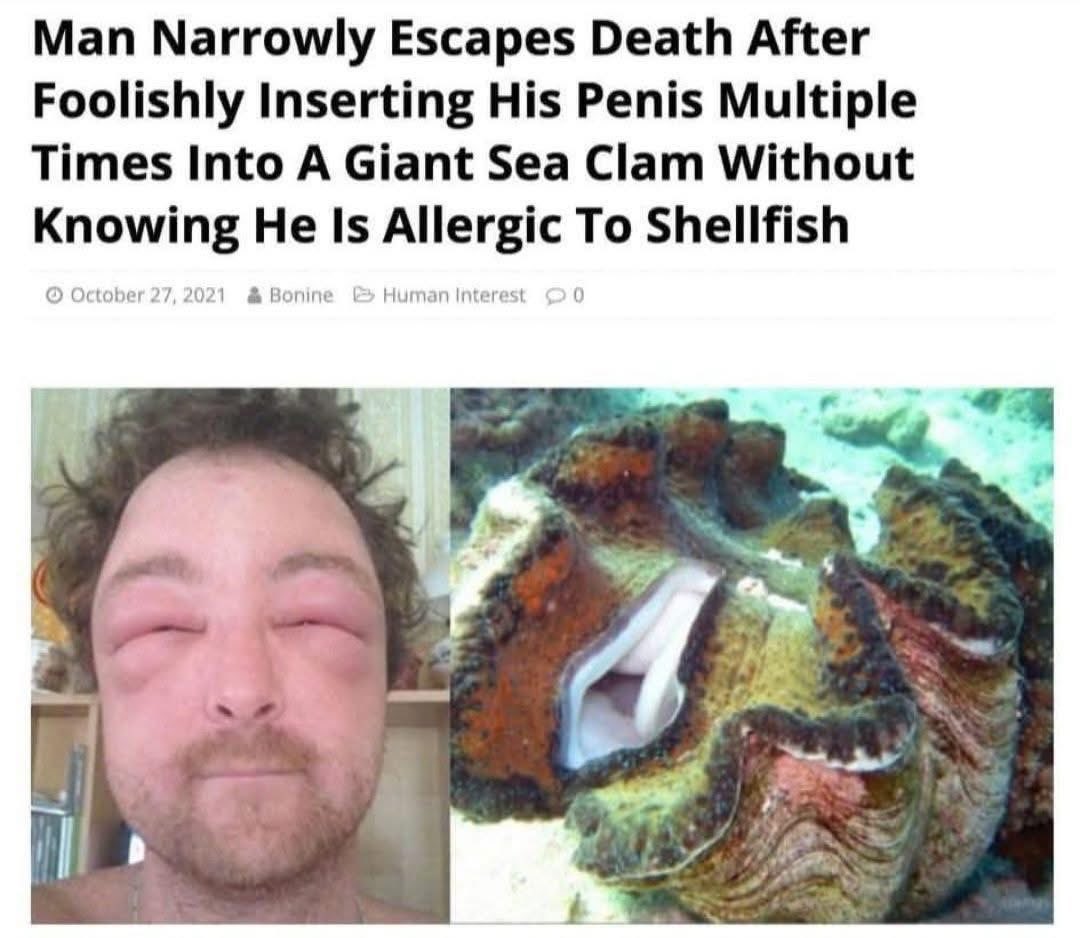 His dietary restrictions are the least of his problems.