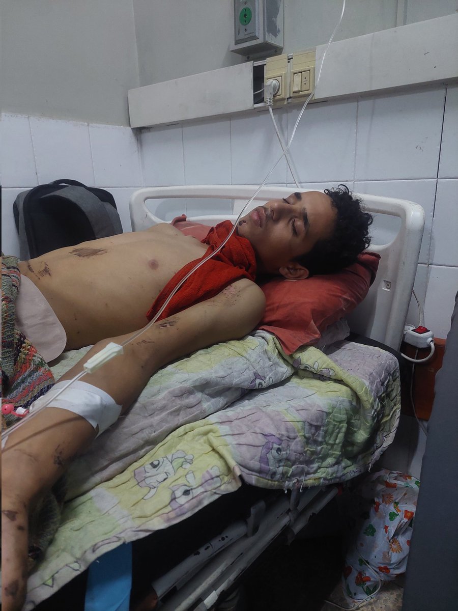 Tamer_Moshtaha's tweet photo. 8261€/9000🎯
Please don't cross please 
Please share this post so it reaches as many people as possible.
My brother Karim is between life and death, and I don't want to lose him like my sisters.
No food
No treatment
No medical care
No surgery
Help us please
📍https://t.co/8Iakjwnhje
📍https://t.co/bKOido1A2h