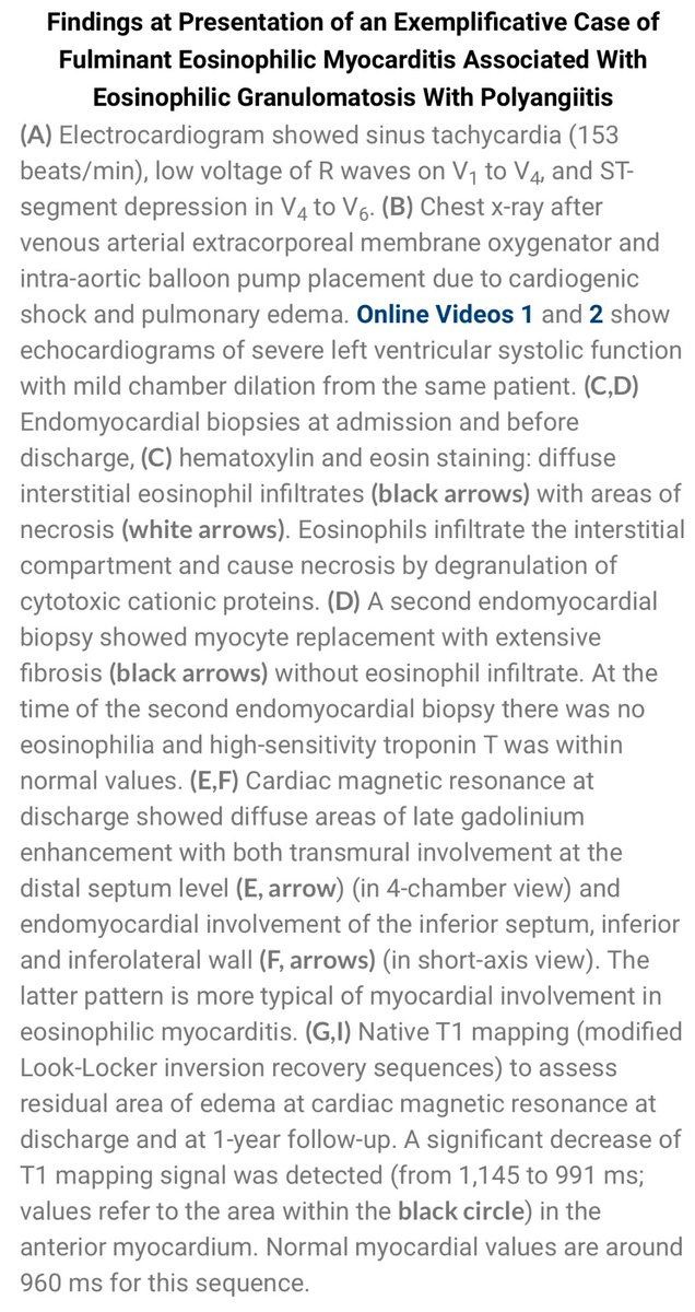 Eosinophilic myocarditis (EM) is a cardiac manifestation of hypereosinophilic syndrome (HES), a rare systemic disease characterized by eosinophilic infiltration, and often accompanied by eosinophilia. Eosinophils invade/damage tissue by releasing active biologic substances.
(1/7)