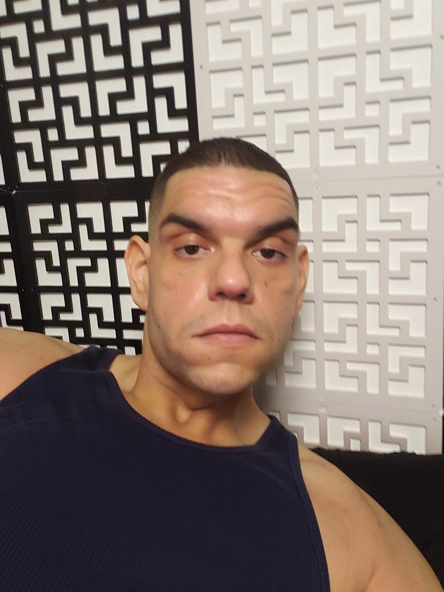 Johncor48747586's tweet image. Got a little tanned #ithurts