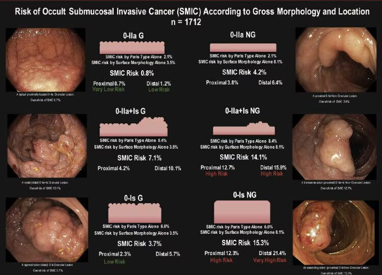 Risk of Submucosal Invasive Cancer Based on Colon Polyp Morphology

Source: Burgess NG, Hourigan LF, Zanati SA, et al. Gastroenterology. 2017;153(3): 732-742.e1.