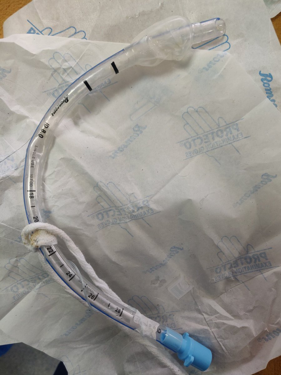 drvimalzenICU's tweet image. Tube Kinking - All possible Dysynchronies
#VentilatorGraphics
#Endotrachealtubeblock
#Dysynchrony