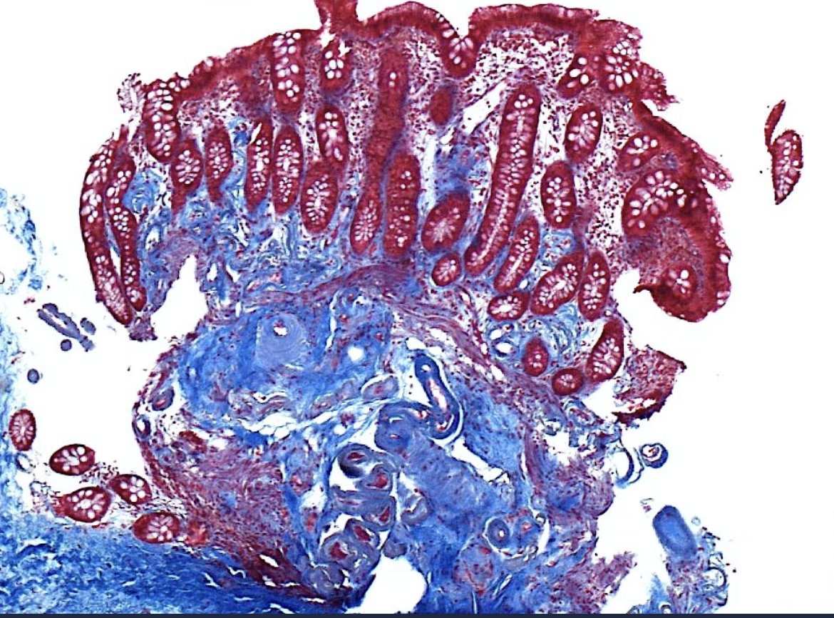 EndoCollab™ | GI Endoscopy Community tweet media