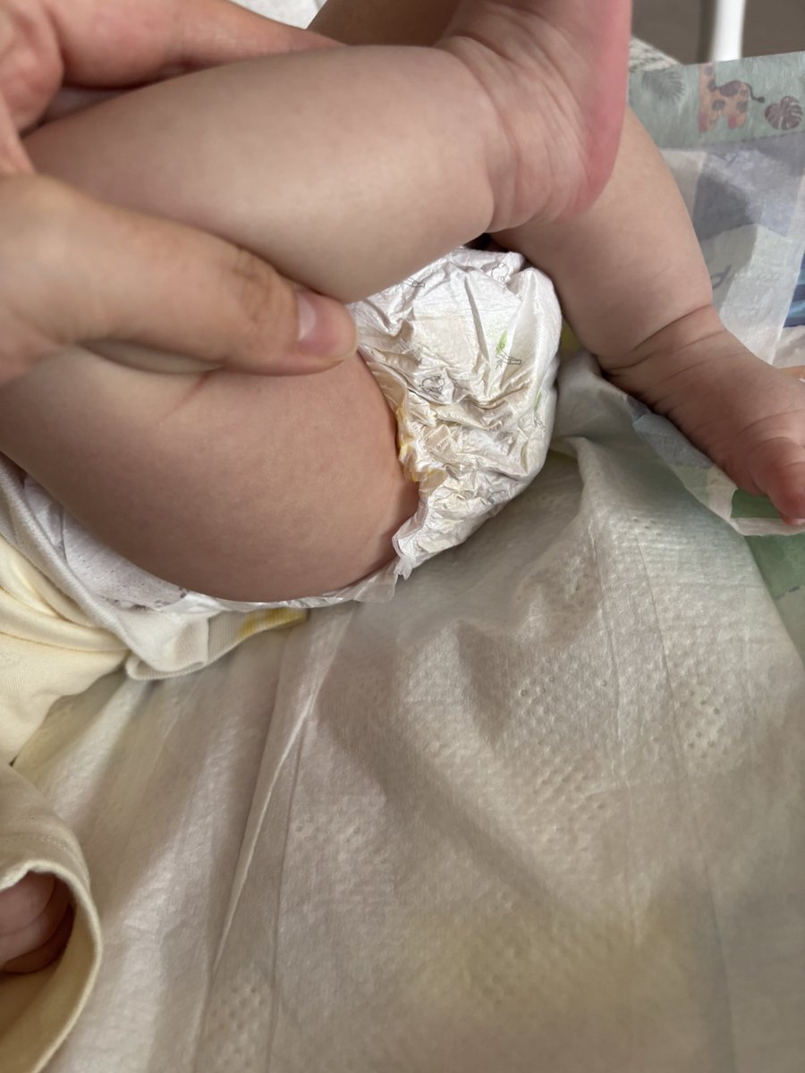 İlk kez Sleepy bez kullandım, pişman oldum. Sürekli sızdırıyor, resmen peçete kıvamında yapılmış. Parayı çöpe atma garantili! Elimde olsa iade edeceğim. Keşke hiç denemeseydim. #sleepy #şikayet rezillik