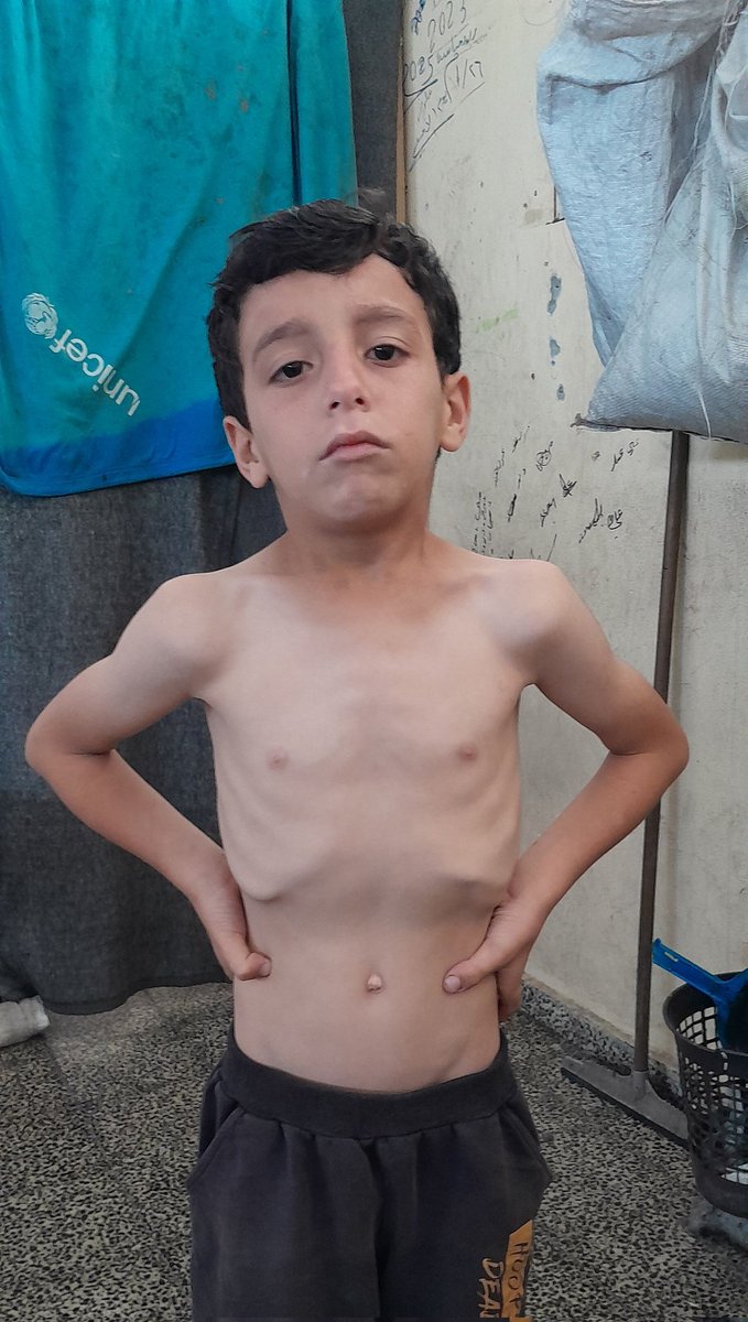 RozeatG's tweet image. Please save my child💔💔 his condition is getting worse due to the lack of food and the high prices. We haven't eaten bread for days and I can't buy it. The price of flour is very expensive. Please save us from starvation and donate😭😭😭🙏🙏🙏
chuffed.org/project/137260…