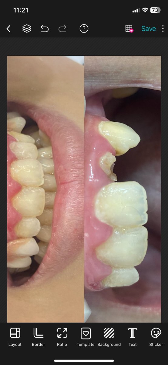 تركيبات الأسنان دكتور محمد سعد العشري