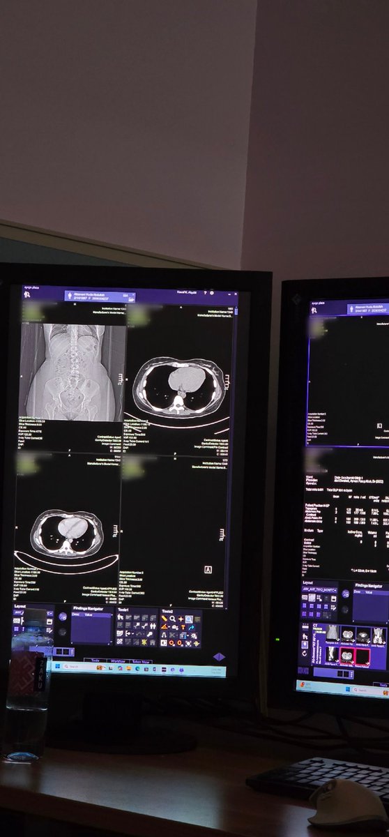 Abdulaziz tweet media