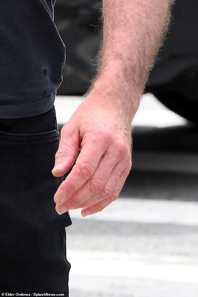 onslavght's tweet photo. his damn furry arm https://t.co/9ILAbB7gSz