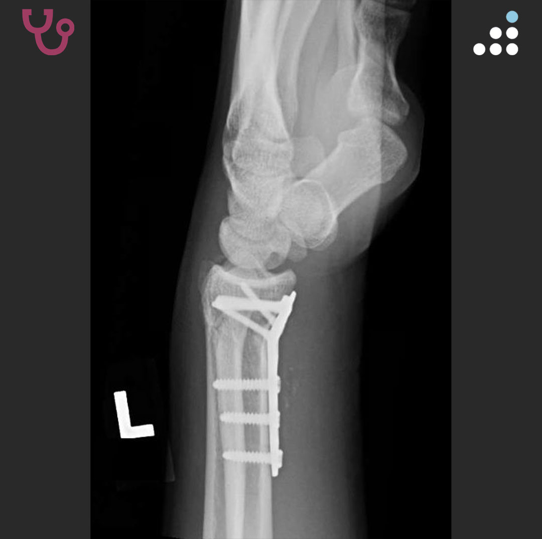 Orthobullets tweet media