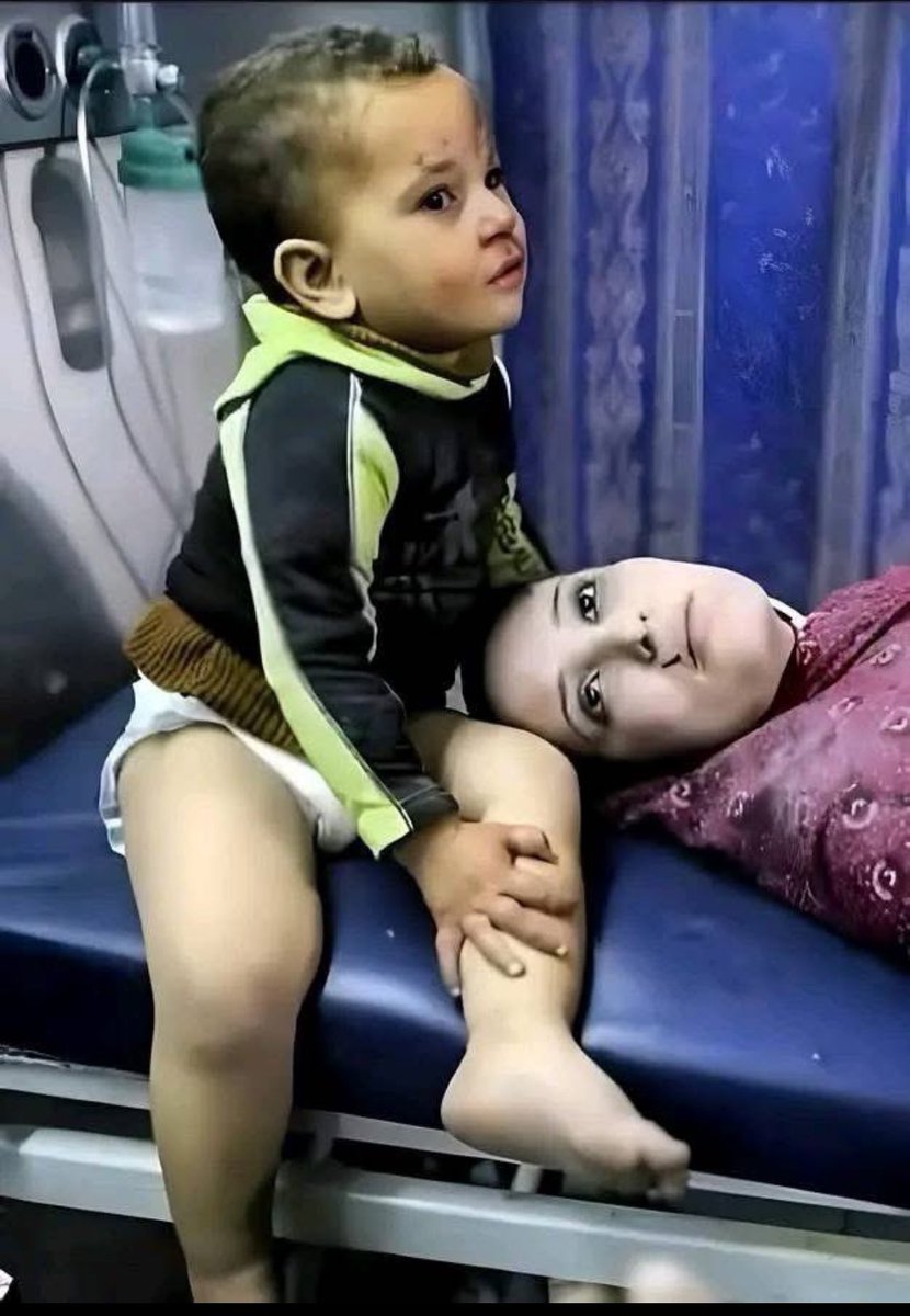 Katil İsrail öldürmeye devam ediyor…
Öldürmüşler !