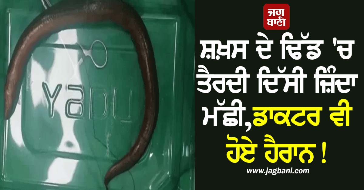 JagbaniOnline's tweet photo. ਇਕ ਅਜਿਹਾ ਹੀ ਮਾਮਲਾ ਚੀਨ ਦਾ ਸਾਹਮਣੇ ਆਇਆ ਹੈ। ਇੱਥੇ ਇੱਕ ਆਦਮੀ ਢਿੱਡ ਵਿੱਚ ਤੇਜ਼ ਦਰਦ ਦੀ ਸ਼ਿਕਾਇਤ ਲੈ ਕੇ ਹਸਪਤਾਲ ਆਇਆ। ਜਦੋਂ ਡਾਕਟਰਾਂ ਨੇ ਉਸਦੀ ਸੀਟੀ ਸਕੈਨ ਕੀਤੀ ਤਾਂ ਅੰਦਰ ਇੱਕ ਫੁੱਟ ਲੰਬੀ ਜ਼ਿੰਦਾ ਮੱਛੀ ਤੈਰਦੀ ਦਿਖਾਈ ਦਿੱਤੀ।
#Livefish #Person #Surgery #Doctor https://t.co/YNCmZUbJXt