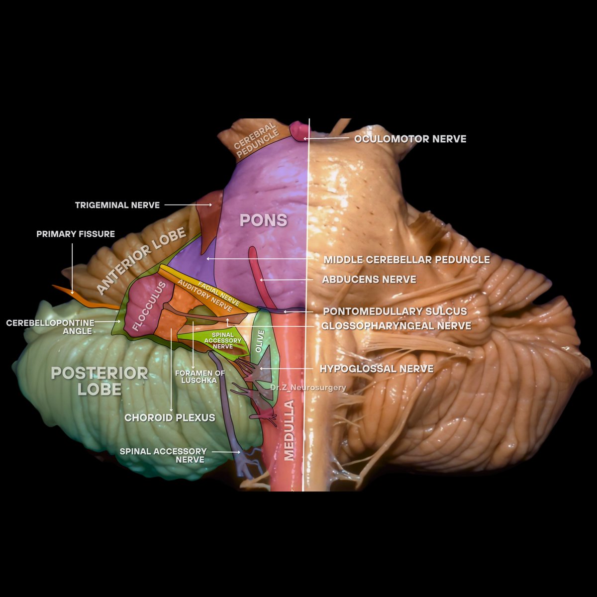 This detailed view of the brainstem and cerebellum reveals the intricate network of cranial nerves and vital structures essential for movement, balance, and coordination.
#Neuroanatomy #Neurosurgery #BrainScience #anatomy
