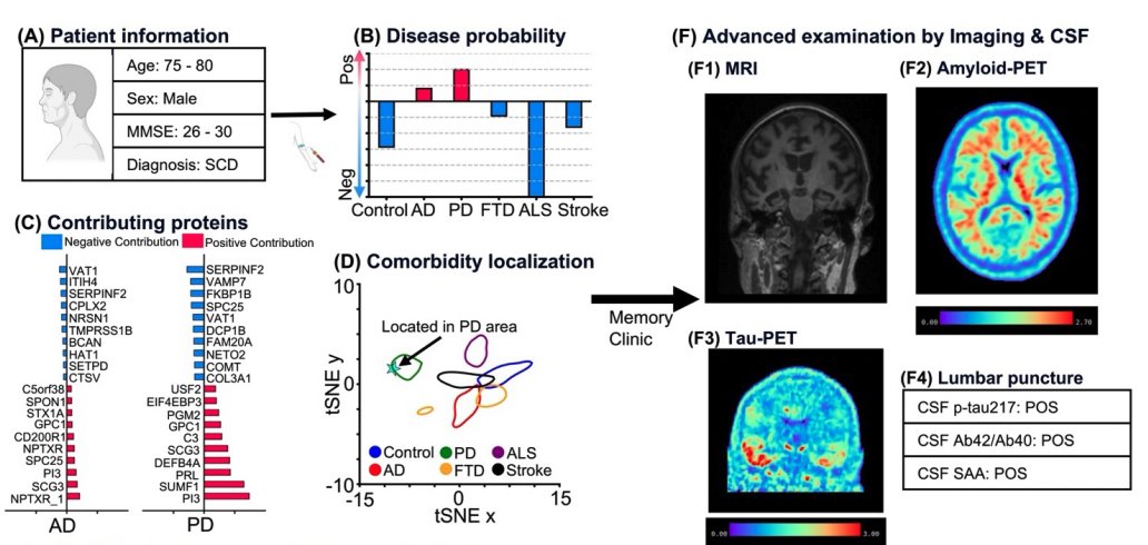5⃣Proteomic signatures of neurodegenerative pathologies

An AI model trained on SomaLogic 7k proteomics from 17,000 individuals detected plasma-based signatures linked to Alzheimer's, Parkinson's, frontotemporal dementia, ALS, and stroke/TIA.

👉Given the clinical overlap &amp; the