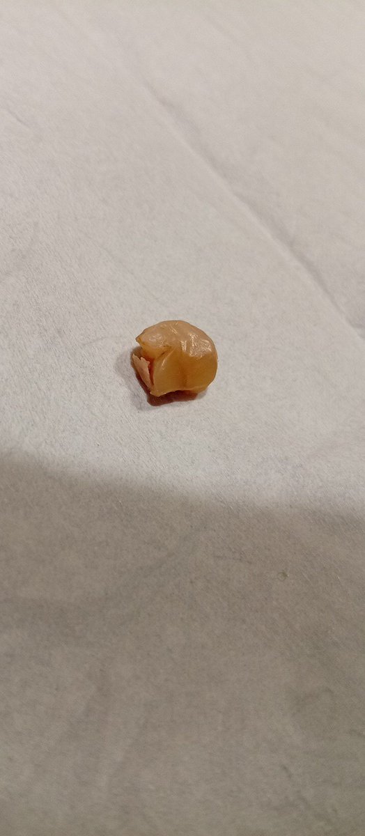 chispitas8's tweet photo. @Mercadona , nos hemos encontrado ésto dentro de una barra de pan, casi perdemos un diente https://t.co/6Xx1YtPwKt