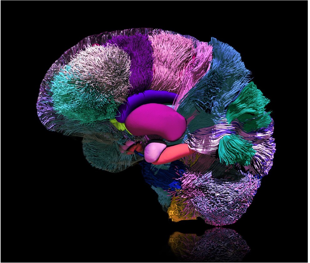 “MindMap: the intricate connections of the human brain” created by Sahar Ahmad, PhD of Chapel Hill, NC, USA.
Discover this “Art of Imaging” article in the latest issue of #RadAdv.
<a href="/RSNA/">RSNA</a> @OUPMedicine
doi.org/10.1093/radadv…