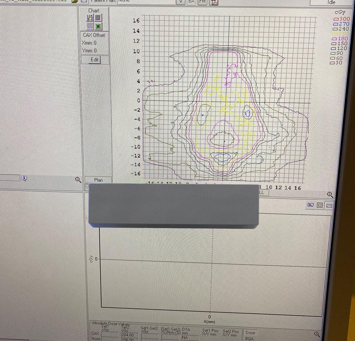 سبحان الله شكل الisodose lines في البلان كأنها رسمة وجه دب🤩😂