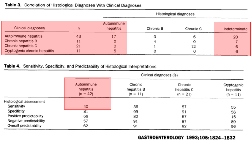 Everything (history, phys exam, 🩸 tests, biopsy, response to treatment) is a diagnostic test with imperfect sensitivity &amp; specificity

You are not a computer. Patients are not multiple choice test questions

We have to learn to live in the grey zone

Biopsy performance in AIH👇