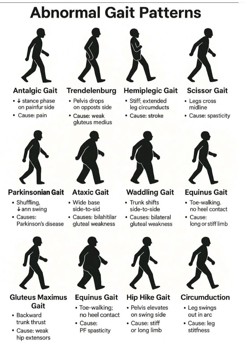 OGdukeneurosurg's tweet photo. Some clues to consider from gait https://t.co/pz4TJOTLDG