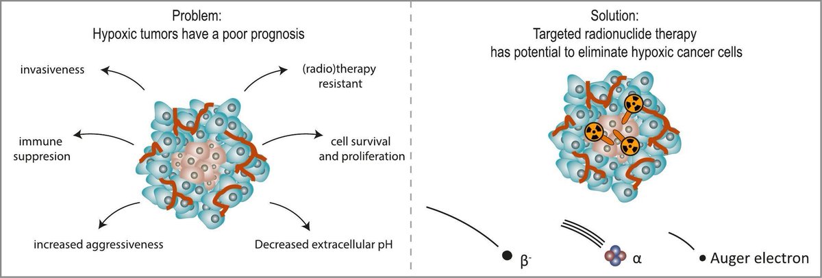 OncTheraX's tweet image. 🎯 The potential of targeted radionuclide therapy to treat hypoxic tumor cells

📖 𝘕𝘶𝘤𝘭𝘦𝘢𝘳 𝘔𝘦𝘥𝘪𝘤𝘪𝘯𝘦 𝘢𝘯𝘥 𝘉𝘪𝘰𝘭𝘰𝘨𝘺
🧪  Sylvia Wenker et al.

🔗 Access the article: sciencedirect.com/science/articl…

#RadionuclideTherapy #Theranostics #Hypoxia #TargetedTherapy