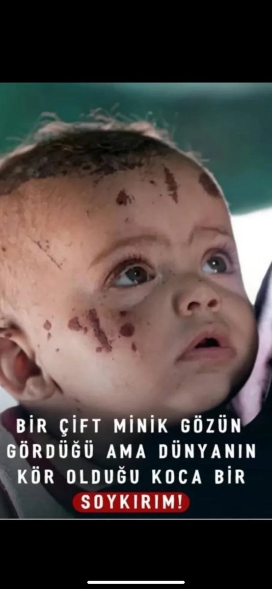 DÜNYA DÜNYA AÇIN GÖZLERİNİZİ GÖRÜN ŞU KÖRPE YAVRUYU 
YETER ARTIK ÇEKDİKLERİ ACILAR