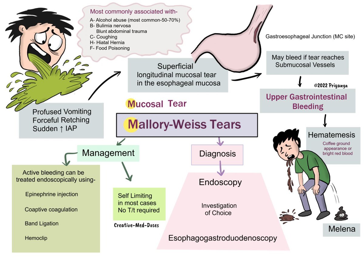 Scott C. Howard (@schowardjd) on Twitter photo <a href="/drkeithsiau/">Keith Siau</a> Mallory-Weiss syndrome
<Image source: <a href="/Creativemeddose/">Creative-Med-Doses</a>, tinyurl.com/22ymxe9a> <a href="/drkeithsiau/">Keith Siau</a> Mallory-Weiss syndrome
<Image source: <a href="/Creativemeddose/">Creative-Med-Doses</a>, tinyurl.com/22ymxe9a>
